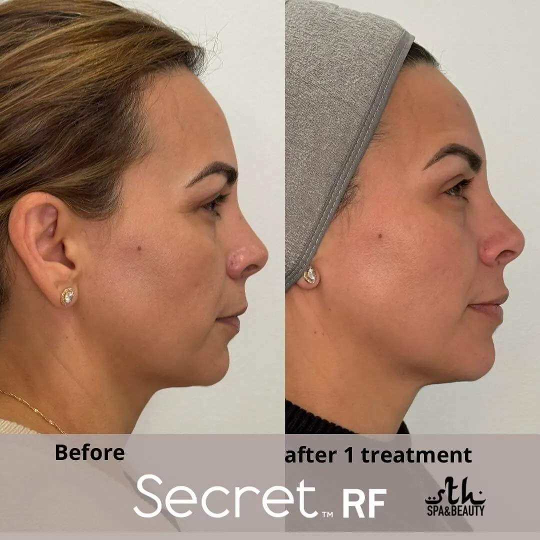 Treatment result