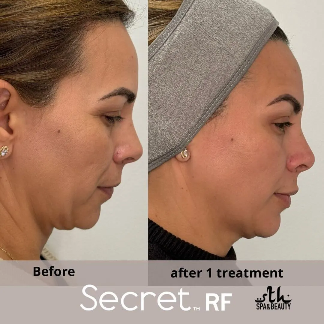 Treatment result